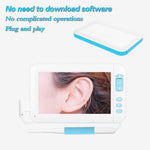 C01 4,3 Zoll Bildschirm Display HD1080P Visueller Ohrenschmalz-Endoskop mit 6 LEDs, Durchmesser: 3,9 mm, C01 3,9 mm
