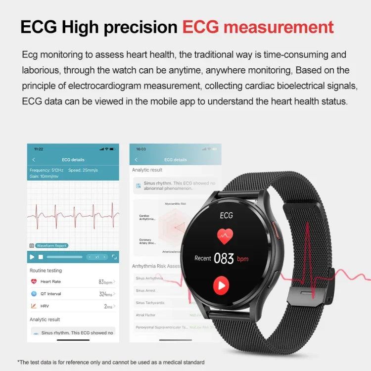 Smartwatch mit Bluetooth-Anruffunktion, Lederarmband (1,43 Zoll), EKG- und nicht-invasiver Blutzuckermessung, Lederarmband schwarz, Lederarmband braun