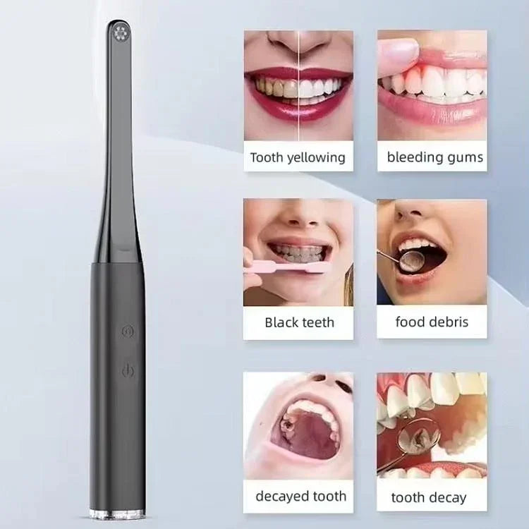 FY-B800 Visuelles Oral-Beobachtungsinstrument Drahtloses WLAN HD-Mundendoskop