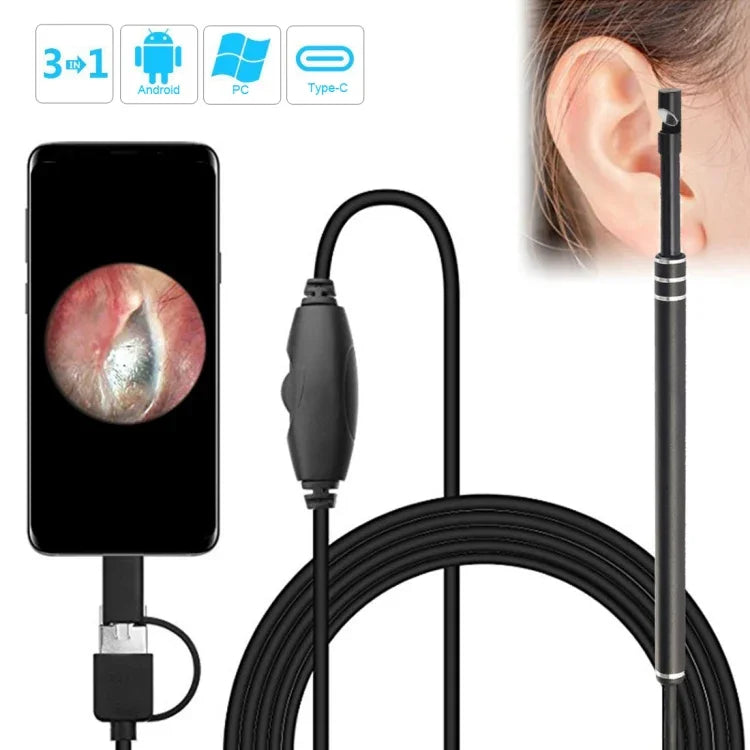 i96 3-in-1 USB Ohr-Endoskop Inspektions HD 0,3MP Kamera Visuelle Ohrenschmalzentfernung für OTG Android Handys & PC & MacBook, 1,85m Kabellänge, 3-in-1 Schwarz 0,3MP