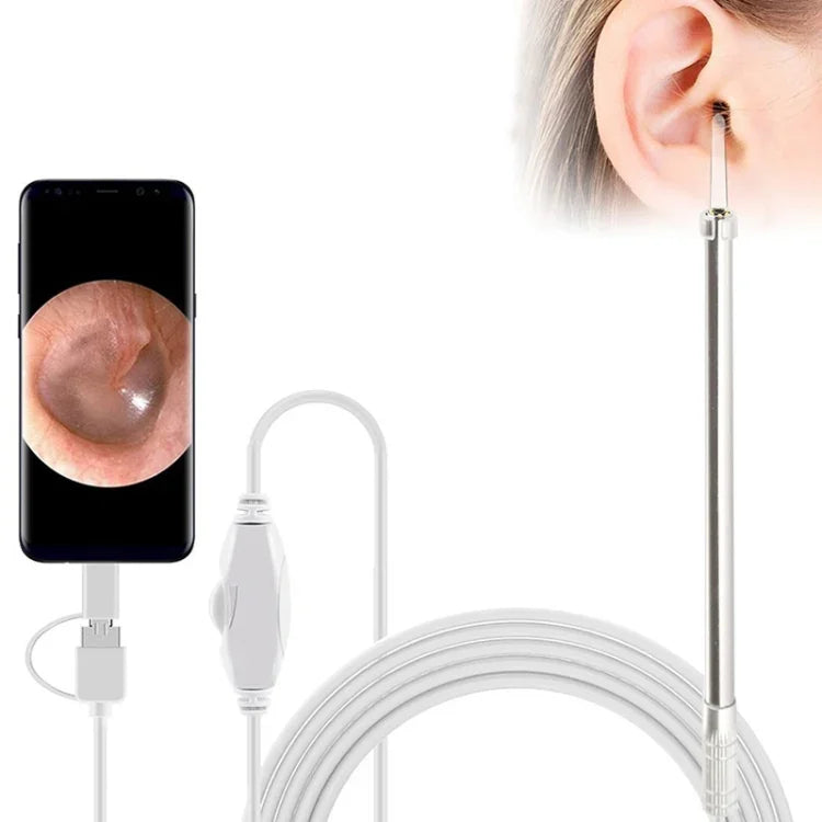 i95 3-in-1 USB Ohr-Endoskop Inspektions HD 0,3MP Kamera Visueller Ohrenschmalz-Entferner für OTG Android-Smartphones & PC & MacBook, 1,75m Kabellänge, 3-in-1 Weiß 0,3MP