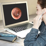 i95 3-in-1 USB Ohr-Endoskop Inspektions HD 0,3MP Kamera Visueller Ohrenschmalz-Entferner für OTG Android-Smartphones & PC & MacBook, 1,75m Kabellänge, 3-in-1 Weiß 0,3MP