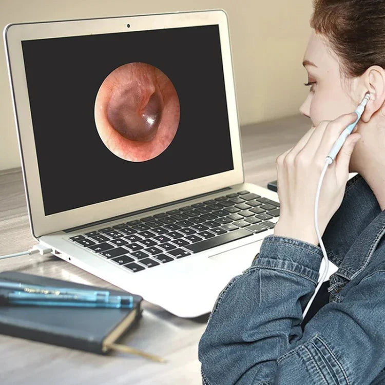 i95 3-in-1 USB Ohr-Endoskop Inspektions HD 0,3MP Kamera Visueller Ohrenschmalz-Entferner für OTG Android-Smartphones & PC & MacBook, 1,75m Kabellänge, 3-in-1 Weiß 0,3MP