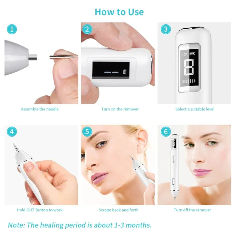 Xpreen XPRE061 professioneller Entferner für dunkle Flecken, Sommersprossen, Tätowierungen, aufladbarer Warzen- und Muttermalentferner, mit LED-Bildschirm und Spotlicht