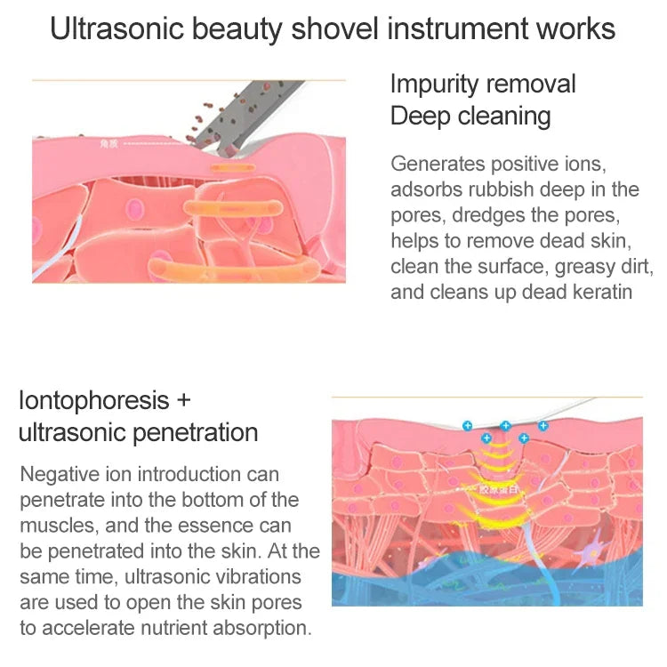 BLK-D016 Ultraschall Beauty Shovel Skin Machine Vibration Haushalt Gesichtsreinigung und Waschmassageinstrument Schönheitsinstrument