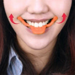 Mini Smile Orthotics Tool Smile Maker, Farbauswahl zufällig, Smile Orthotics Tool