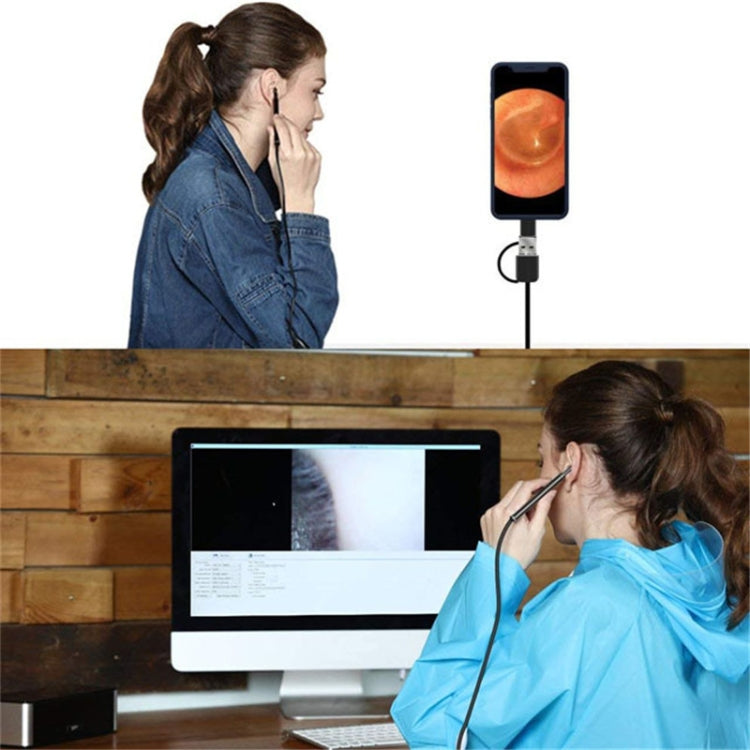 3-in-1 USB HD Digital Inspektions Otoskop Ohr-Typ Digital Endoskop Ohrenschmalz