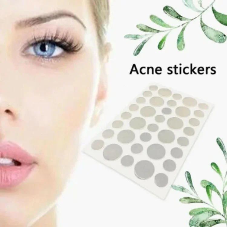 3-teiliges Akne-Tool-Set zur Behandlung von Aknenarben und Pickel-Stickern