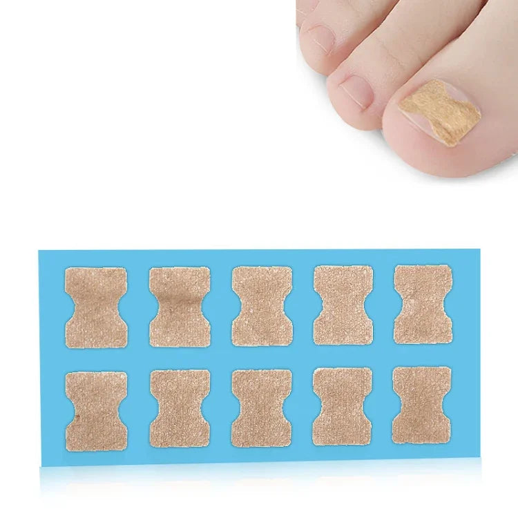 10 Stück klebstofffreie orthopädische Zehennagel-Einlagen zur Korrektur von Nagelrillen, transparente Unterseite, weiße Unterseite, blaue Unterseite