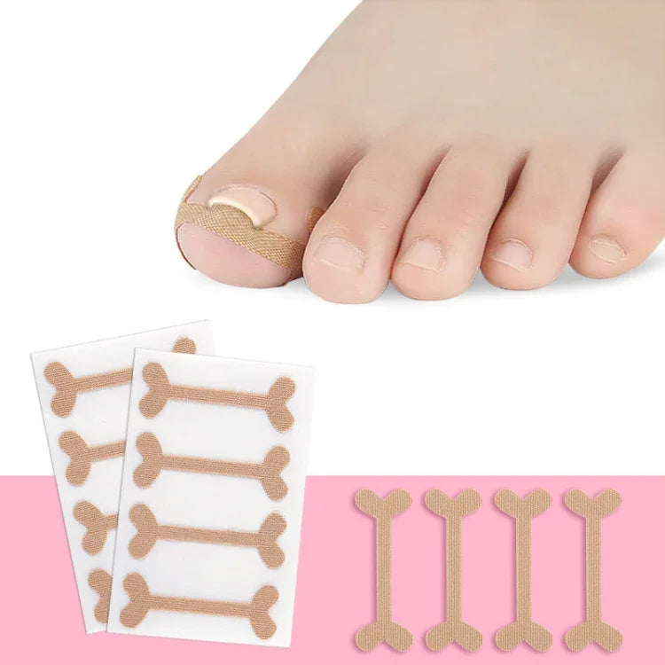 10 Sets gerolltes Nagelkorrekturband Zehennagelrillenband
