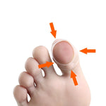 Eingewachsene Nägel verhindern das Nagelwachstum – Nagelkorrekturen aus Fleisch, Einheitsgröße