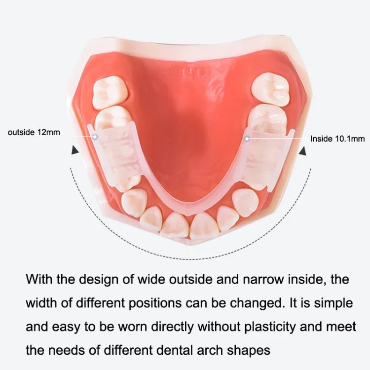 Y-Kelin Kieferorthopädische Apparatur Silikon Simulationsspangen Anti-Molar-Zahnspangen für die Nacht, Transparent