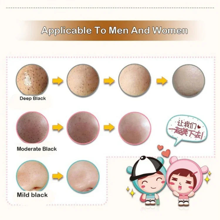3-teiliges Beauty-Set mit Schweinenasenmaske zur Entfernung von Mitessern und Akne, 3-Schritte-Set für hautfarbene Haut, blau und rot